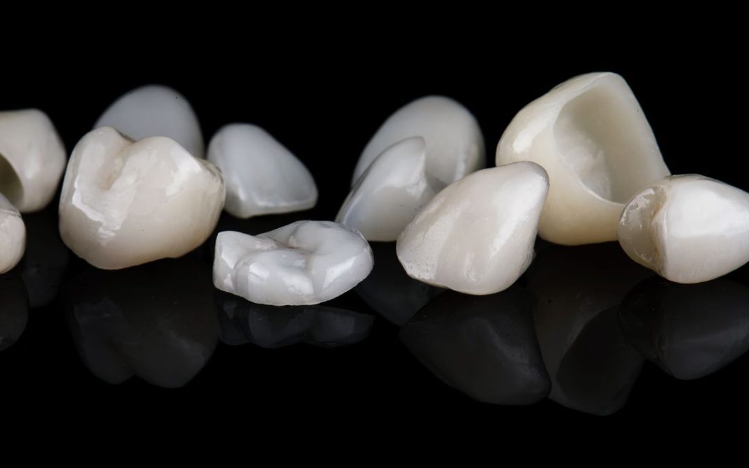 Porcelain Crowns in Cedar Park | Reveal Dental