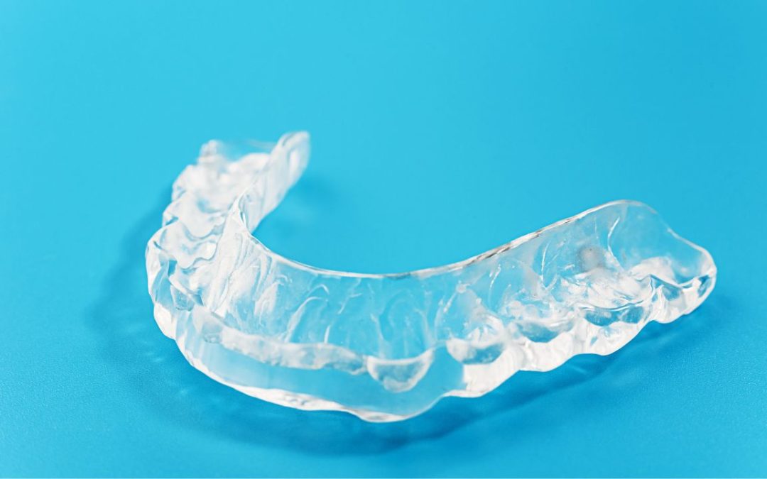 Mouthguard | Reveal Dental
