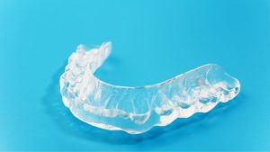 Mouthguard | Reveal Dental