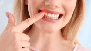 Gum Disease | Reveal Dental