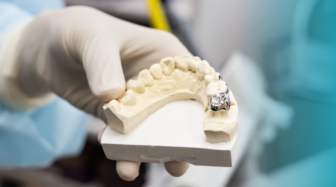 How Same-Day Crowns Can Transform Your Smile — Without Waiting Weeks