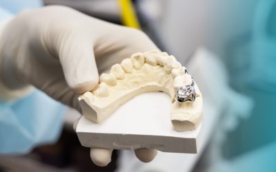 How Same-Day Crowns Can Transform Your Smile — Without Waiting Weeks