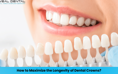 How to Maximize the Longevity of Dental Crowns?