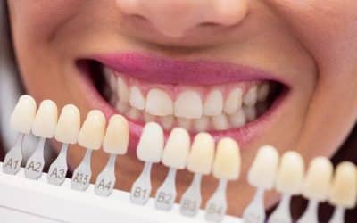 Veneers vs. Lumineers: Which is Right for You? A Cedar Park Dentist Explains