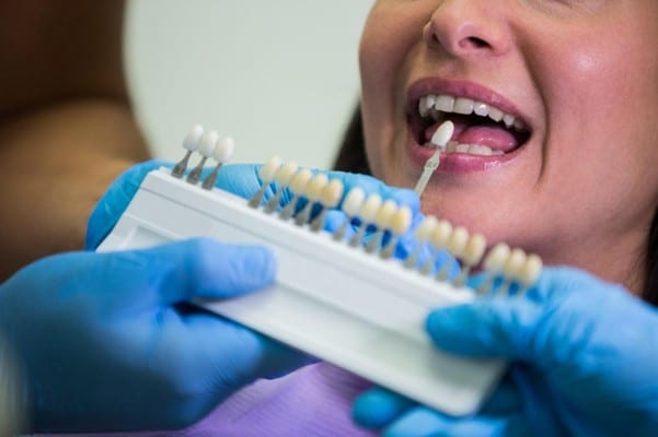 Permanent Porcelain Crowns