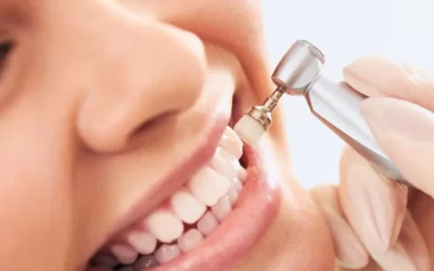 Discover the Best Teeth Whitening Options for You