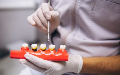 Comprehensive Guide to Dental Implants – Benefits, Types, Comparison, Procedure, & Cost